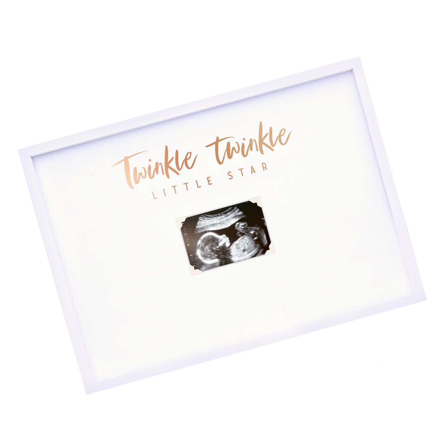 Baby Scan Frame Baby Shower Guest Book Alternative